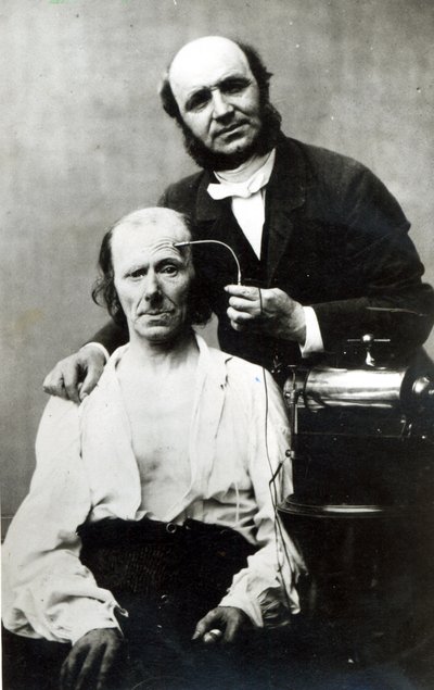 Duchenne de Boulogne con un paciente víctima, 1862 de French Photographer